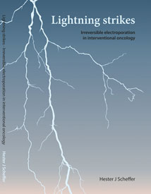 lightning strikes